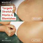 Besque Original Magic Body Oil, 3.4 FL OZ, After Shower Body Oil For Women,