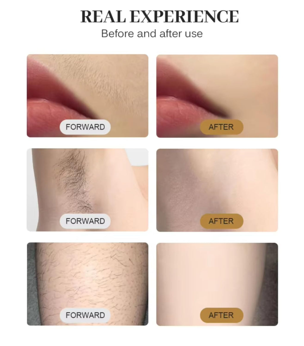 4 in 1 Professional Hair Removal Device for Men Women Durable Multifunctional