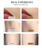 4 in 1 Professional Hair Removal Device for Men Women Durable Multifunctional