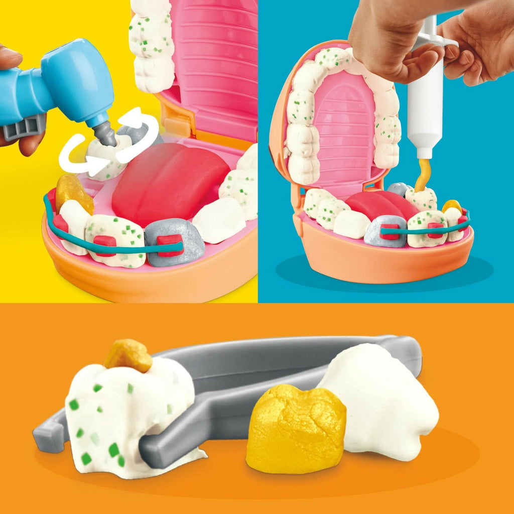 Play-Doh Drill 'n Fill Dentist Toy for Kids 3 Years and Up with Cavity and