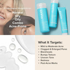 Paula's Choice CLEAR Regular Strength Acne Kit, 2% Salicylic Acid & 2.5% Benzoyl