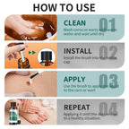 ELEFOCUS Wart Remover Liquid - 12% Wart Liquid with Salicylic Acid  Fast Acting