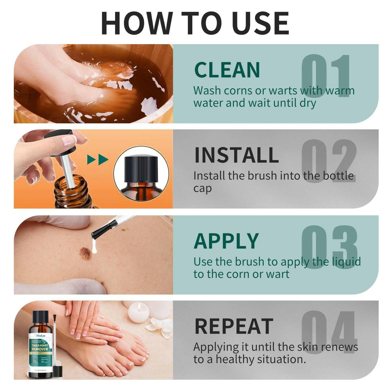 ELEFOCUS Wart Remover Liquid - 12% Wart Liquid with Salicylic Acid  Fast Acting