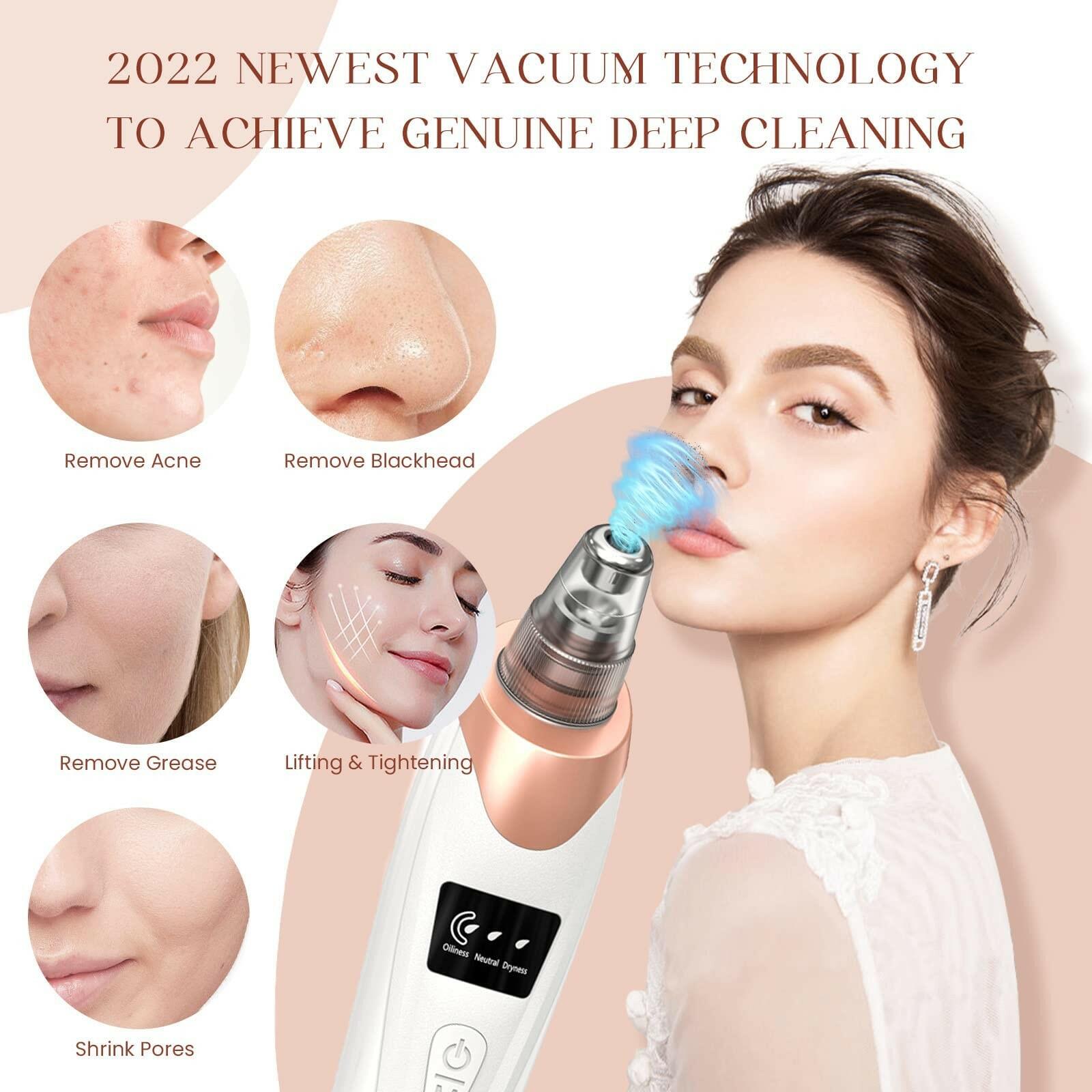 2025 Blackhead Remover Pore Vacuum,Facial Pore Cleaner-5 Suction Power,5