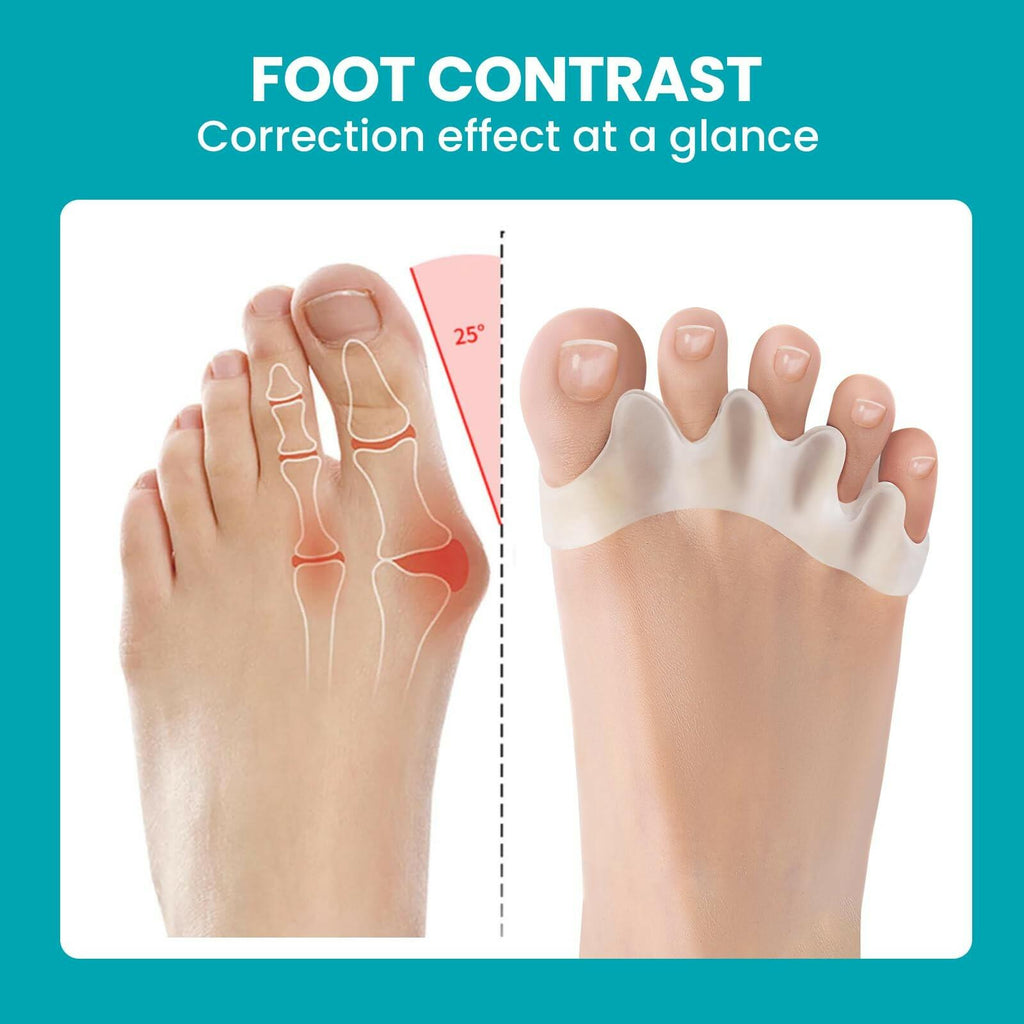 8 Pack Toe Separators for Correct Bunions - Promifun Toe Spacers for Women and