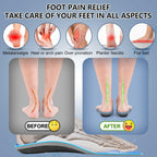 Size 11 AOTENG STAR Plantar Fasciitis Insoles, High Arch Support Insoles for