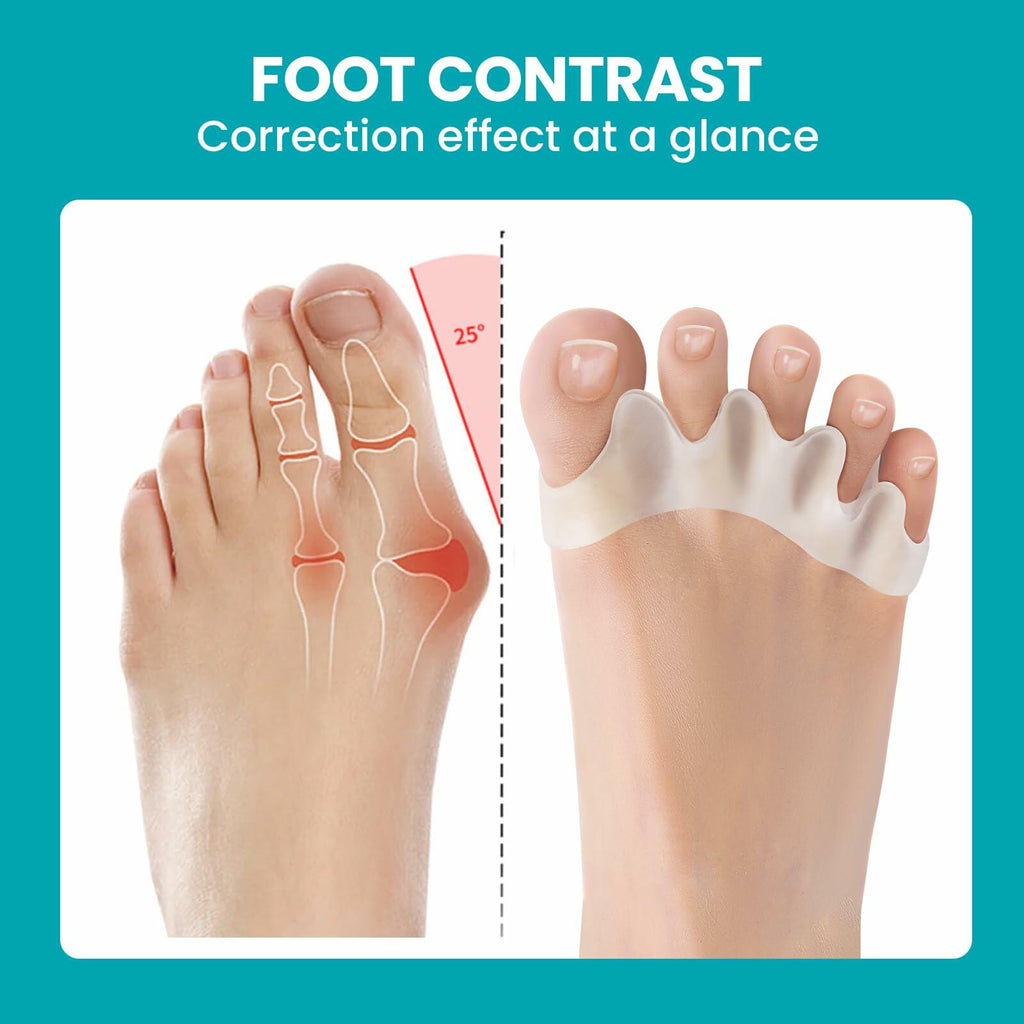 8 Pack Toe Separators for Correct Bunions - Promifun Toe Spacers for Women and