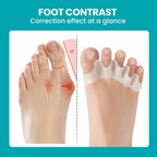 8 Pack Toe Separators for Correct Bunions - Promifun Toe Spacers for Women and
