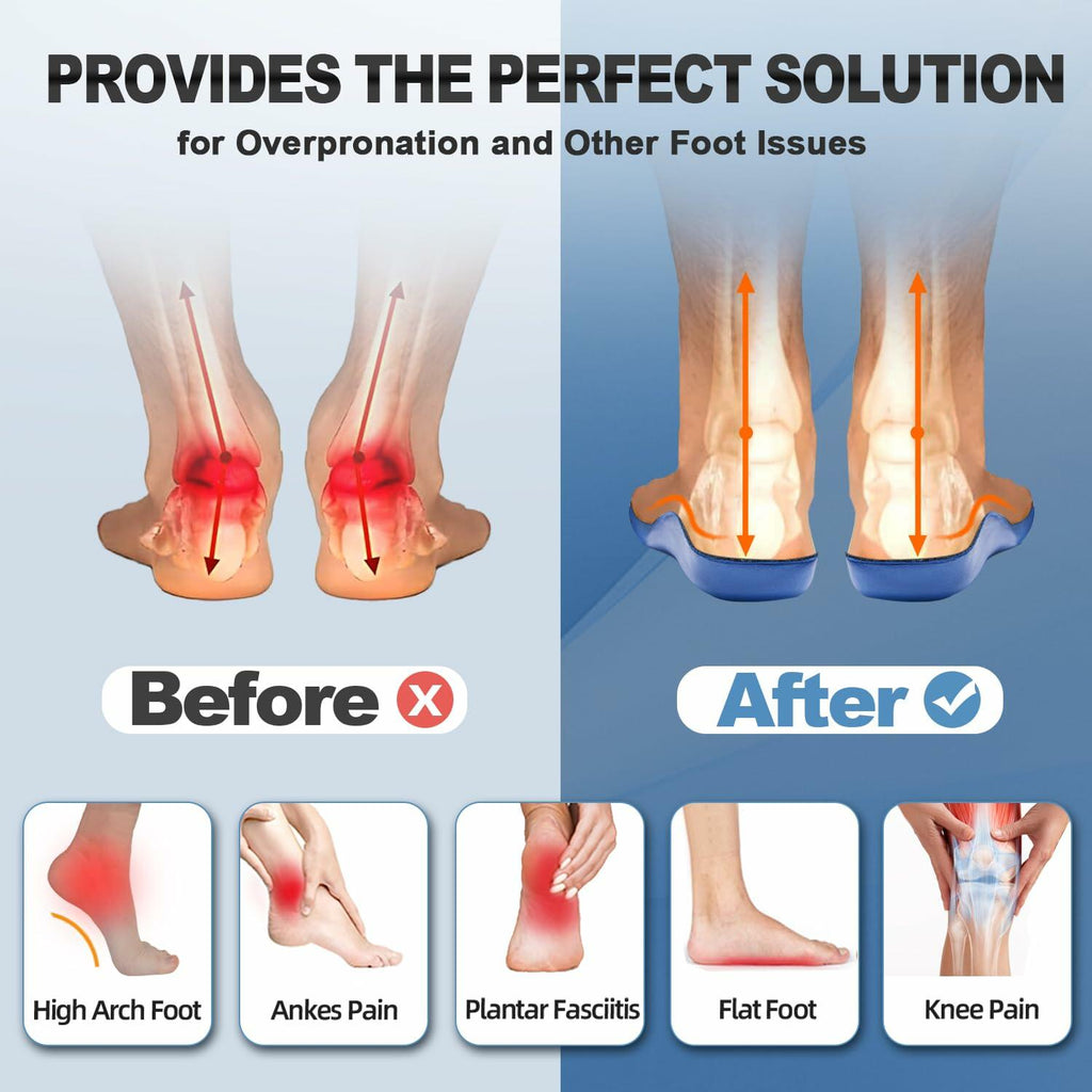 Men OrthoComfoot Plantar Fasciitis Relief Comfort Insoles Size 40 Low Arch