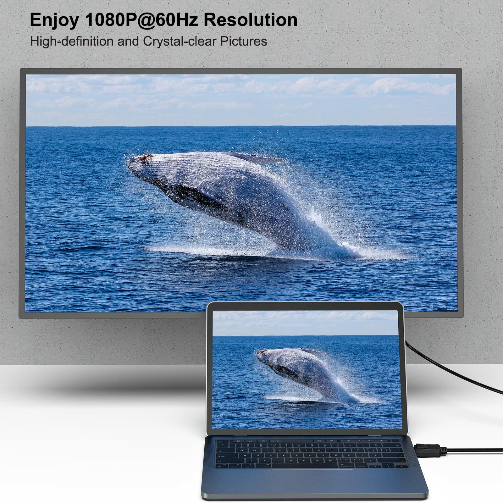 BENFEI DisplayPort to DVI 6 Feet Cable, DisplayPort to DVI Adapter Male to Male