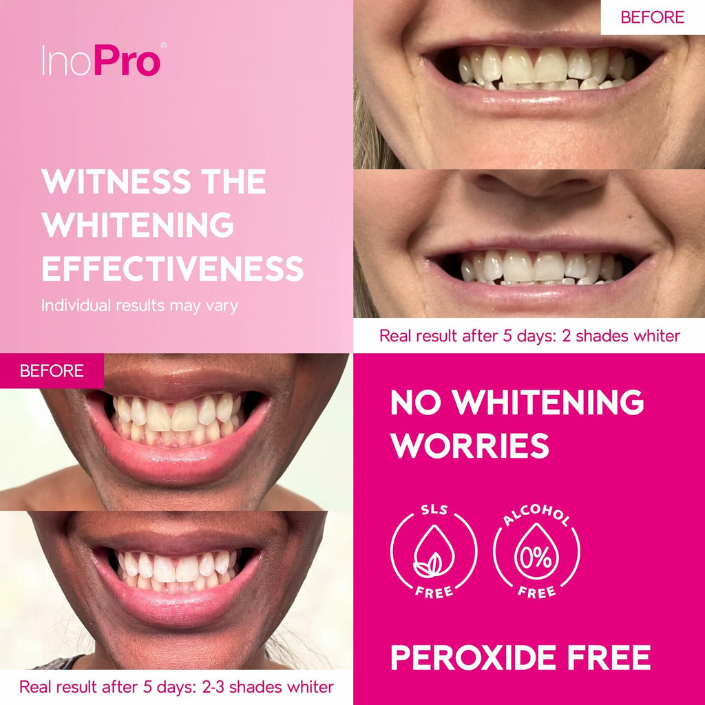 InoPro Teeth Whitening Strips 14 Treatments Kit - Enamel Safe Teeth Whitener,