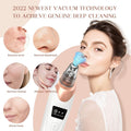 2025 Blackhead Remover Pore Vacuum,Facial Pore Cleaner-5 Suction Power,5
