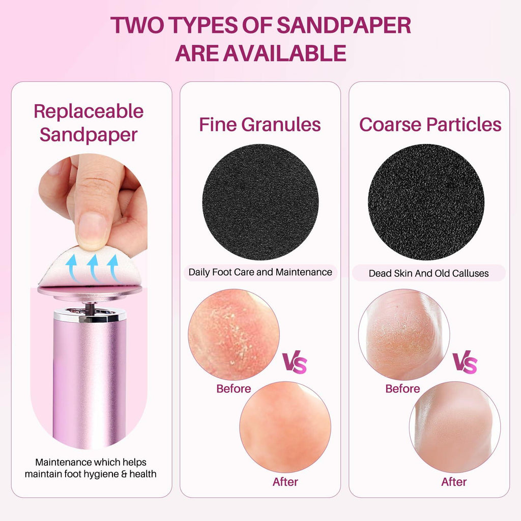 LIONVISON Electric Foot Callus Remover: Adjustable Speed Foot File for Cracked