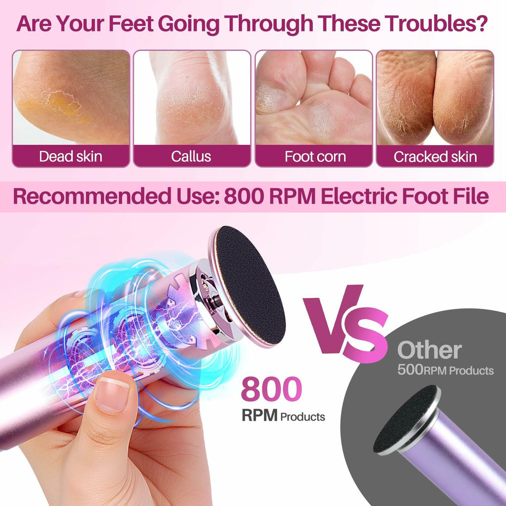 LIONVISON Electric Foot Callus Remover: Adjustable Speed Foot File for Cracked