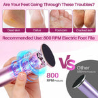 LIONVISON Electric Foot Callus Remover: Adjustable Speed Foot File for Cracked