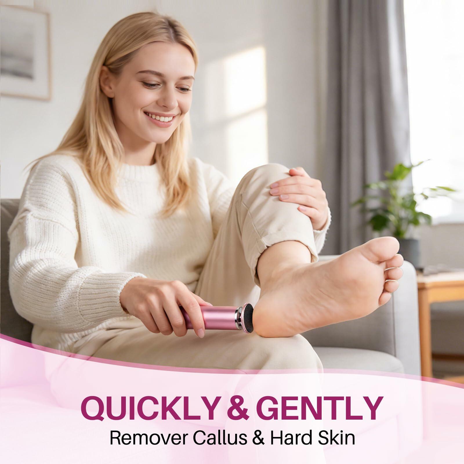 LIONVISON Electric Foot Callus Remover: Adjustable Speed Foot File for Cracked